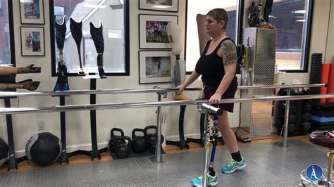 Layla's Inspiring Journey: Hemipelvectomy Amputee Progress.